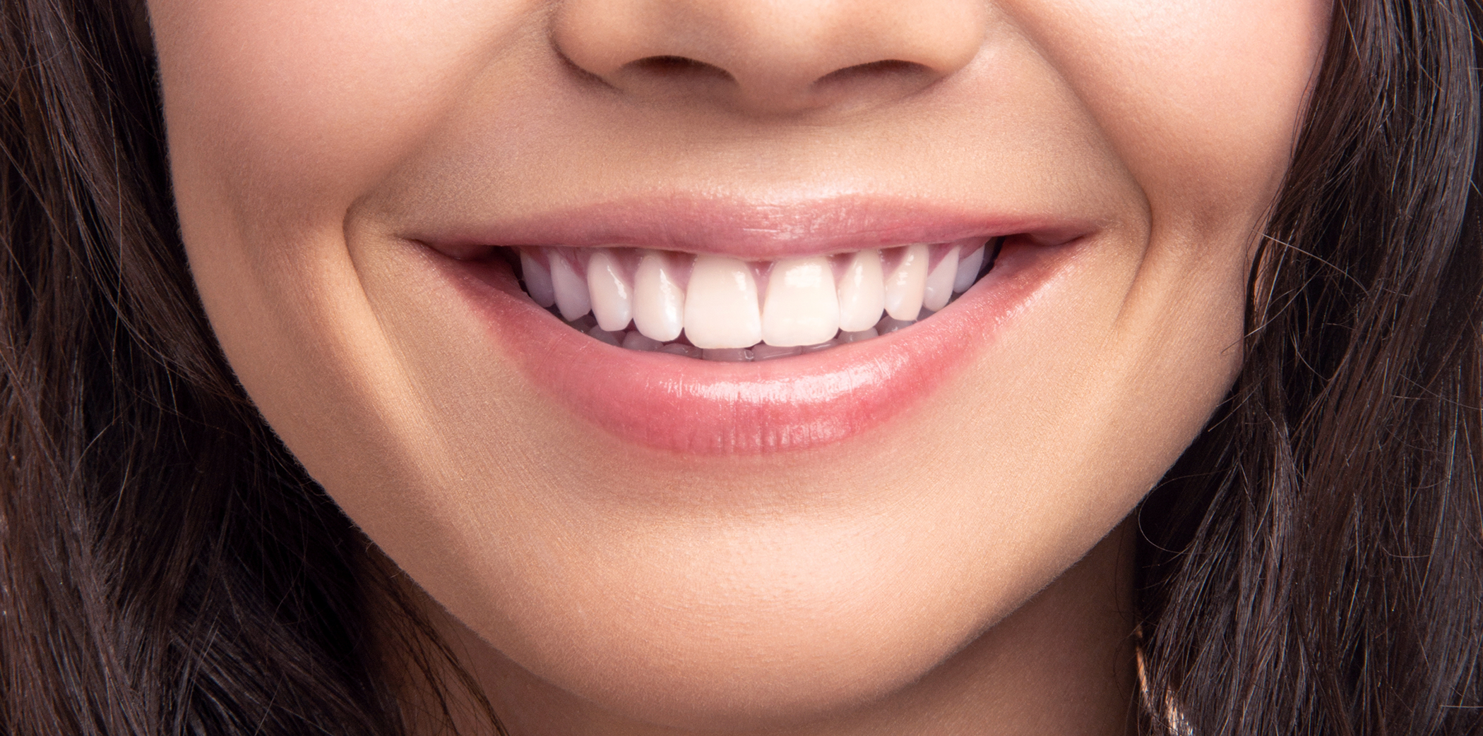 Close up of a woman with a flawless smile after endodontic treatment in Bartlett