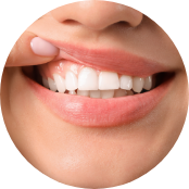 Close up of a person pointing to their gums